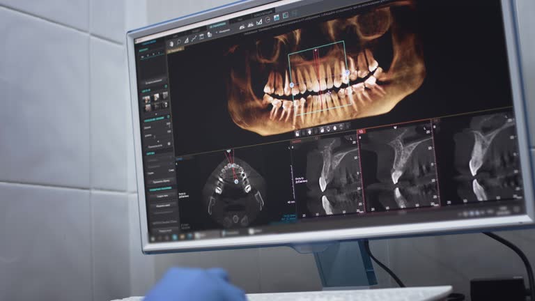 Oral Cancer Screening in Clark, SD