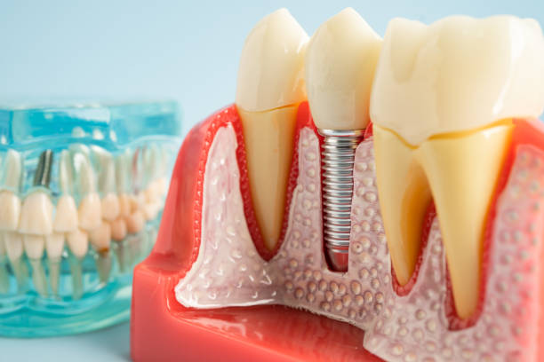 Best Dental Exams and Cleanings  in Clark, SD